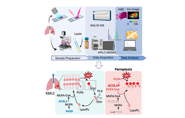 Cancer as a matter of FAT: emerging roles of lipids in Ferroptosis and cancer cell death