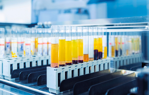 Automation in Drug Discovery
