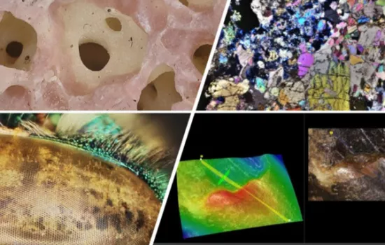 Microscopia digitale e confocale 3D